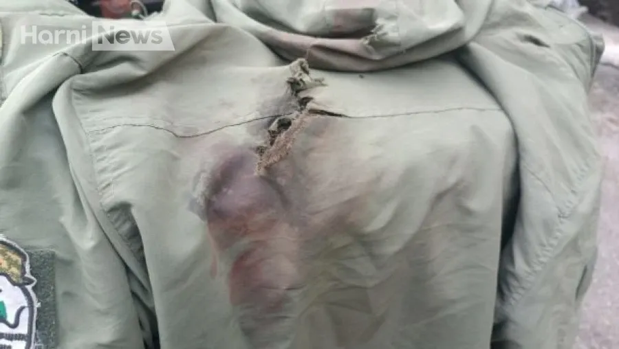 Газова гангрена на передовій: чи встигнуть зупинити блискавичну інфекцію?