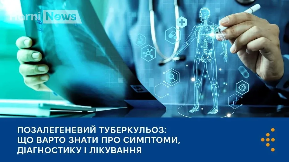 Туберкульоз поза легенями: симптоми, діагностика і безоплатне лікування – головне, що треба знати
