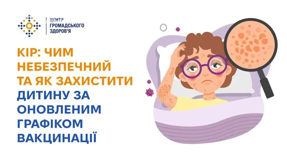 Кір у дітей: симптоми, ризики та коли робити щеплення КПК у 1 і 4 роки